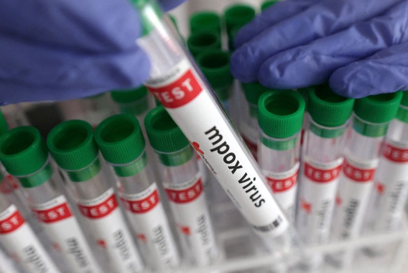 © Reuters. FILE PHOTO: A test tube labelled